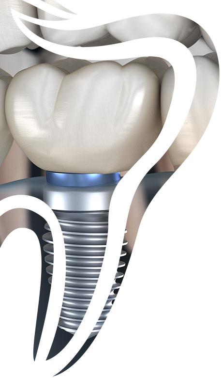 especialidades-dentales-alcala-de-henares-belen-villacastin